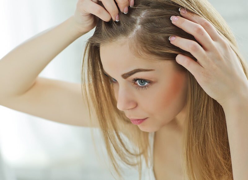 زراعة الشعر في تركيا للنساء بدون حلاقة