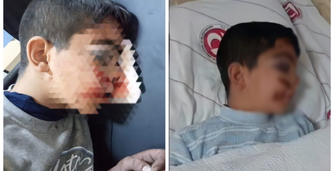 طفل سوري يتعرض للضـ ـرب المبـ ـرح من قبل رجل تركي (35 عاماً)